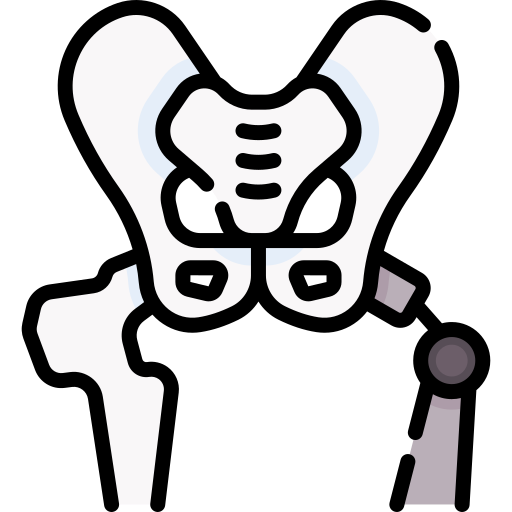 Hip Replacement
